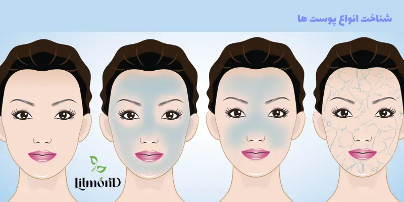 Reasons for diagnosing skin types