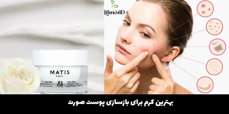 بهترین کرم برای بازسازی پوست صورت