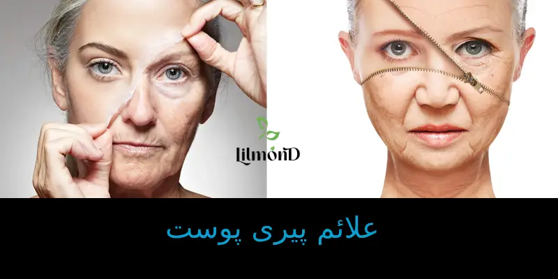 علائم پیری پوست