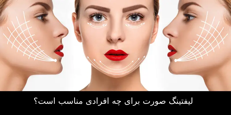 لیفتینگ صورت برای چه افرادی مناسب است؟ (1)