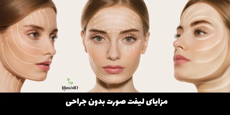 مزایای لیفت صورت بدون جراحی