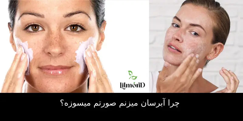 چرا آبرسان میزنم صورتم میسوزه